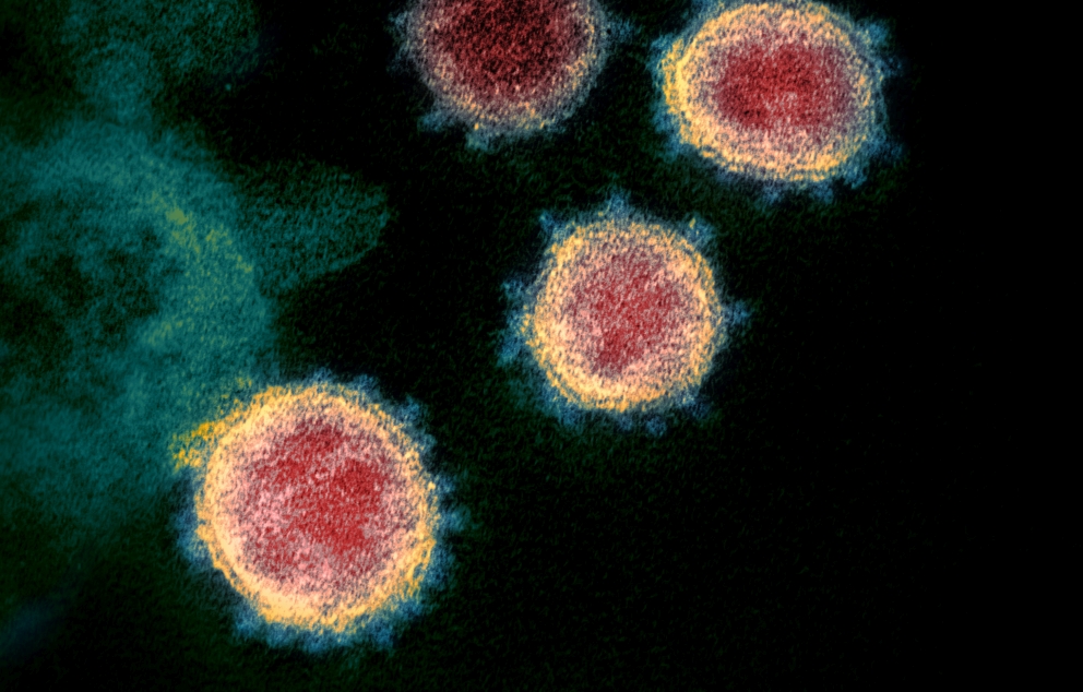 הגדלה במיקרוסקופ אלקטרונים של וירוס SARS-CoV-2 שגרם להתפרצות מחלת הקורונה (COVID-19)   מקור: ויקיפדיה